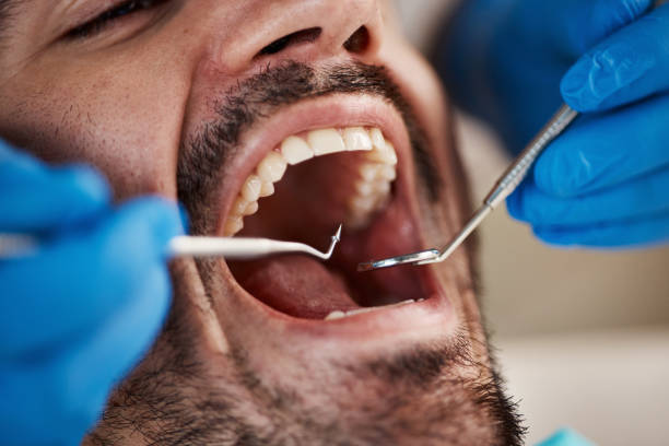 Best Urgent Care for Lost Fillings or Crowns in Hueytown, AL